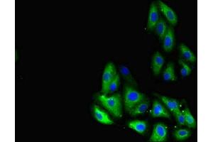 Immunofluorescent analysis of HepG2 cells using ABIN7153873 at dilution of 1:100 and Alexa Fluor 488-congugated AffiniPure Goat Anti-Rabbit IgG(H+L) (GLP1R antibody  (AA 24-145))