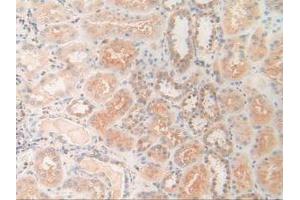 Figure. (PDXK antibody  (AA 29-253))