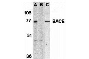 Western Blotting (WB) image for anti-Beta-secretase 1 (BACE1) (C-Term) antibody (ABIN1030276) (BACE1 antibody  (C-Term))