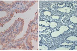 Immunohistochemistry of mouse Anti-AKT pS473 (MOUSE) Biotin Conjugated  at 40X Tissue: prostate Fixation: FFPE buffered formalin 10% conc Antigen retrieval: Heat, Citrate pH 6. (AKT1 antibody  (Internal Region, pSer473) (Biotin))