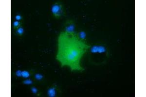 Anti-FAM84B mouse monoclonal antibody (ABIN2453035) immunofluorescent staining of COS7 cells transiently transfected by pCMV6-ENTRY FAM84B (RC207996). (FAM84B antibody)