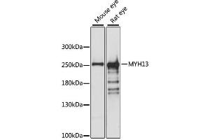 Western blot analysis of extracts of various cell lines, using MYH13 antibody. (MYH13 antibody)