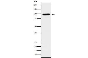 Western blot analysis of GLB1 expression in SH-SY5Y cell lysate. (Recombinant GLB1 antibody)
