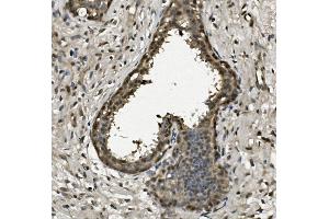 IHC analysis of RPA32/RPA2 using anti-RPA32/RPA2 antibody (ABIN7601380). (RPA2 antibody  (AA 34-254))