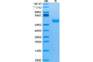 Biotinylated Human IL-5 R alpha/CD125 on Tris-Bis PAGE under reduced condition. (IL5RA Protein (AA 21-335) (His-Avi Tag,Biotin))