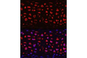 Immunofluorescence (IF) image for anti-Cartilage Oligomeric Matrix Protein (COMP) (AA 20-160) antibody (ABIN6138864)