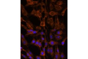 Immunofluorescence analysis of C6 cells using BRPF1 antibody (ABIN7265938) at dilution of 1:100. (BRPF1 antibody  (AA 1-200))