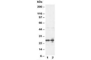 Western blot testing of FGF8 antibody and rat ovary tissue lysate (FGF8 antibody  (C-Term))