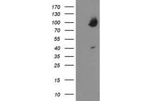 HEK293T cells were transfected with the pCMV6-ENTRY control (Left lane) or pCMV6-ENTRY OSBP (Right lane) cDNA for 48 hrs and lysed. (OSBP antibody)