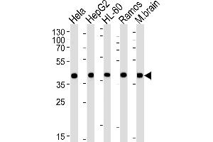Western blot analysis of lysates from Hela, HepG2, HL-60, Ramos, mouse brain cell line (from left to right), using GOT2 Antibody (N-term) (ABIN652917 and ABIN2842590).