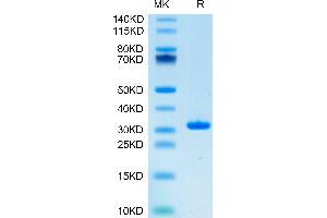SARS-CoV-2 3CLpro (L167F) on Tris-Bis PAGE under reduced condition. (SARS-Coronavirus Nonstructural Protein 8 (SARS-CoV NSP8) (L167F) Protein)