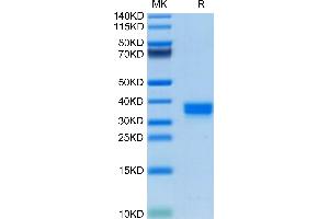 FOLR2 Protein (AA 21-227) (His tag)
