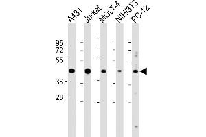 All lanes : Anti-ASS Antibody (Center) at 1:2000 dilution Lane 1: A431 whole cell lysate Lane 2: Jurkat whole cell lysate Lane 3: MOLT-4 whole cell lysate Lane 4: NIH/3T3 whole cell lysate Lane 5: PC-12 whole cell lysate Lysates/proteins at 20 μg per lane.