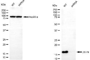 anti-Destrin (Actin Depolymerizing Factor) (DSTN) antibody