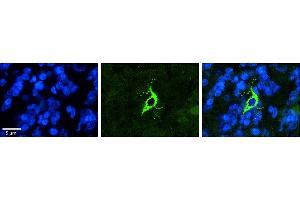 Rabbit Anti-TMX4 Antibody     Formalin Fixed Paraffin Embedded Tissue: Human Pineal Tissue  Observed Staining: Cytoplasmic in cell bodies and processes of pinealocytes  Primary Antibody Concentration: 1:100  Secondary Antibody: Donkey anti-Rabbit-Cy3  Secondary Antibody Concentration: 1:200  Magnification: 20X  Exposure Time: 0. (TMX4 antibody  (C-Term))