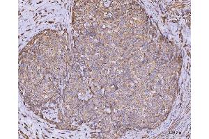 IHC analysis of CLASP1 using anti-CLASP1 antibody (ABIN7599144). (CLASP1 antibody  (AA 1-243))