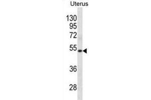 KRT72 Antibody (Center) (ABIN1881487 and ABIN2838797) western blot analysis in human Uterus tissue lysates (35 μg/lane).