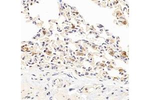 Immunohistochemistry of paraffin embedded rat lung using HSP70B (ABIN7074173) at dilution of 1: 1000 (400x lens) (HSPA6 antibody)