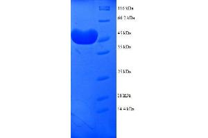 Proteasome Subunit alpha  7 (PSMA7) (AA 5-232), (partial) protein (GST tag)