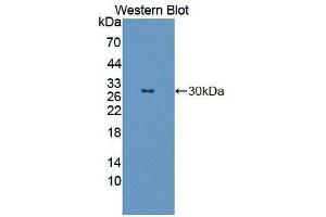 Western blot analysis of the recombinant protein. (INSRR antibody  (AA 1067-1296))
