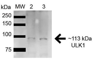 Western blot analysis of Rat Brain cell lysates showing detection of ~112. (ULK1 antibody  (AA 567-577) (Biotin))
