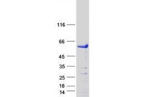 Validation with Western Blot