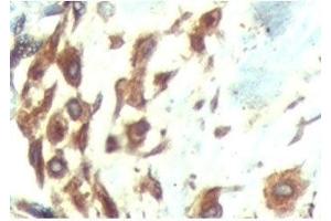 IHC testing of FFPE human breast tissue with ATF6 antibody at 5ug/ml.