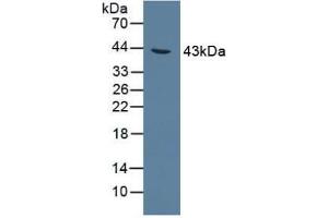 Detection of AGXT in Rat Liver Tissue using Polyclonal Antibody to Alanine Glyoxylate Aminotransferase (AGXT) (AGXT antibody  (AA 182-371))