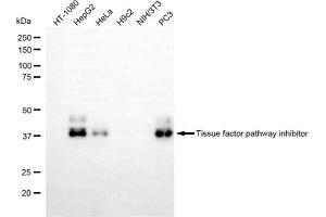 Western blotting analysis using tissue factor pathway inhibitor antibody (ABIN7800559). (Recombinant TFPI antibody)
