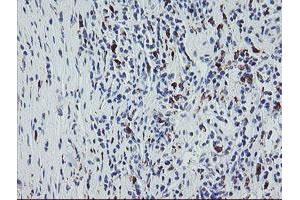 Image no. 2 for anti-Coagulation Factor XIII, A1 Polypeptide (F13A1) antibody (ABIN1498146) (F13A1 antibody)