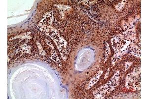 Immunohistochemistry (IHC) analysis of paraffin-embedded Human Skin, antibody was diluted at 1:100. (alpha 2 Macroglobulin antibody  (Internal Region))