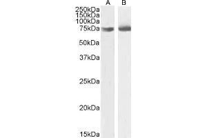 (ABIN185551) (2 μg/mL) staining of HEK293 (A),and A431 (B) nuclear cell lysate (35 μg protein in RIPA buffer). (OGFR antibody  (C-Term))