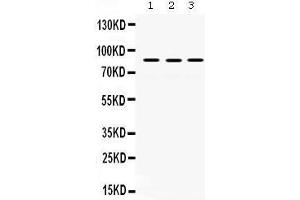Western Blotting (WB) image for anti-MutL Homolog 1 (MLH1) (AA 722-756), (C-Term) antibody (ABIN3043404) (MLH1 antibody  (C-Term))