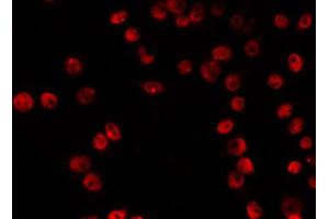 ABIN6266828 staining RAW264. (VPS72 antibody  (Internal Region))