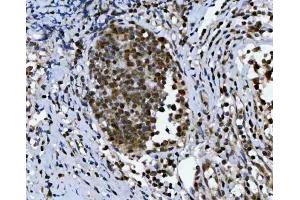 IHC analysis of TRIR using anti-TRIR antibody (ABIN7603244). (Uncharacterized Protein C19orf43 (TRIR) (N-Term) antibody)