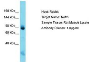 Image no. 1 for anti-Neurofilament Triplet M Protein (NEFM) (C-Term) antibody (ABIN6750526) (NEFM antibody  (C-Term))