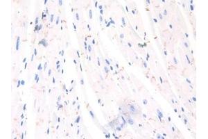 Immunohistochemistry (IHC) image for anti-Cadherin 2 (CDH2) (AA 45-238) antibody (ABIN7437500)