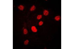 Immunofluorescent analysis of CstF-64 staining in HeLa cells. (CSTF2 antibody  (N-Term))