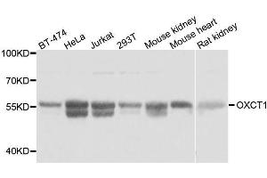 Western blot analysis of extracts of various cell lines, using OXCT1 antibody. (OXCT1 antibody  (AA 261-520))