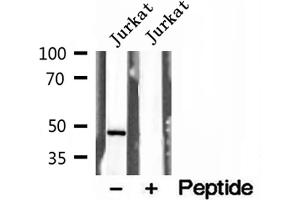 Western blot analysis of extracts of Jurkat cells, using Annexin VII antibody.