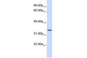 Image no. 1 for anti-F-Box Protein 25 (FBXO25) (AA 36-85) antibody (ABIN6740798) (FBXO25 antibody  (AA 36-85))