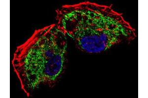 Immunofluorescence (IF) image for anti-Transcription Factor A, Mitochondrial (TFAM) antibody (ABIN5015230) (TFAM antibody)