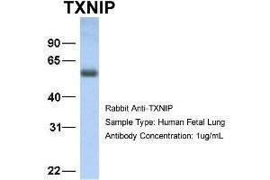 Host: Rabbit Target Name: TXNIP Sample Type: Human Fetal Lung Antibody Dilution: 1. (TXNIP antibody  (C-Term))