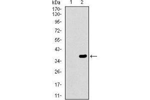 Western blot analysis using ABCG5 mAb against HEK293 (1) and ABCG5 (AA: 306-367)-hIgGFc transfected HEK293 (2) cell lysate. (ABCG5 antibody  (AA 306-367))