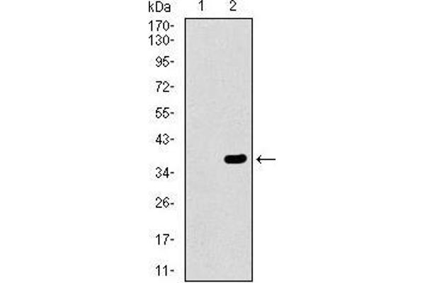 ABCG5 antibody  (AA 306-367)