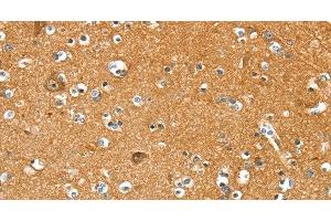 Immunohistochemistry of paraffin-embedded Human brain using PYGL Polyclonal Antibody at dilution of 1:35