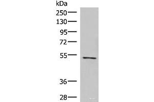 Western blot analysis of Jurkat cell lysate using POLD2 Polyclonal Antibody at dilution of 1:800 (POLD2 antibody)