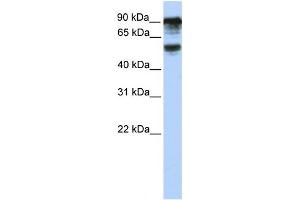 WB Suggested Anti-TBC1D10B Antibody Titration: 0. (TBC1D10B antibody  (C-Term))