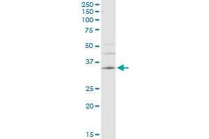 CA4 monoclonal antibody (M08), clone 4G6. (CA4 antibody  (AA 27-126))