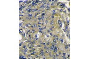 Immunohistochemistry (IHC) image for anti-C-Fos Induced Growth Factor (Vascular Endothelial Growth Factor D) (Figf) antibody (ABIN3002601) (VEGFD antibody)